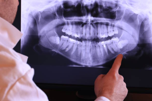 Best Urgent Care for Lost Fillings or Crowns in Centerton, AR